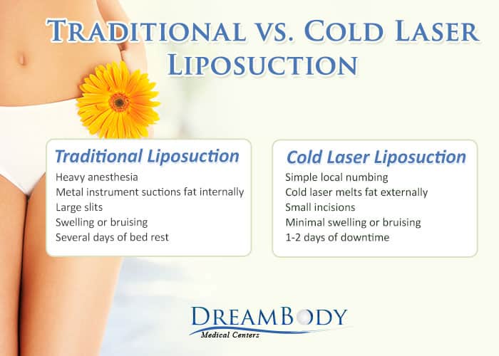 Traditional Lipo vs. Cold Laser Lipo