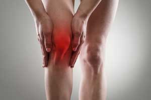 illustrating inflammation in the knee
