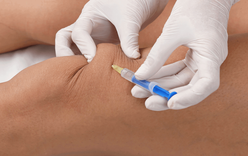Prolotherapy Being Performed by a Naturopath